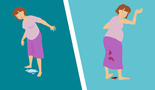 l2-premature-birth-id10094-03.jpg